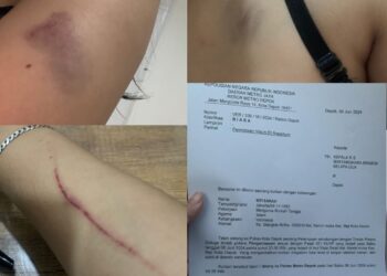 Buntut Keributan Di Inul Vista Margonda, Pengacara Tegaskan Kliennya Adalah Korban