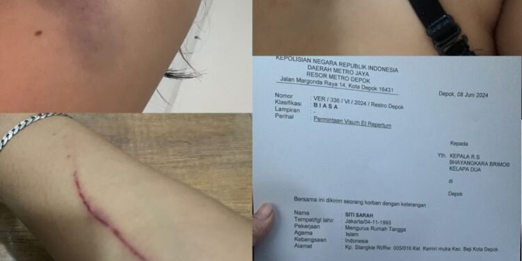 Buntut Keributan Di Inul Vista Margonda, Pengacara Tegaskan Kliennya Adalah Korban