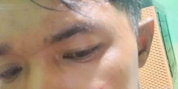 Polres Metro Depok Sidik Laporan Penganiayaan Wartawan Rizky oleh Istri Sirihnya